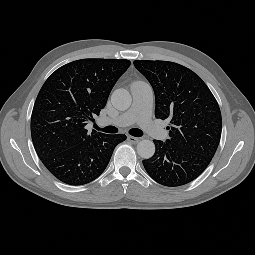 Representative axial chest CT image.