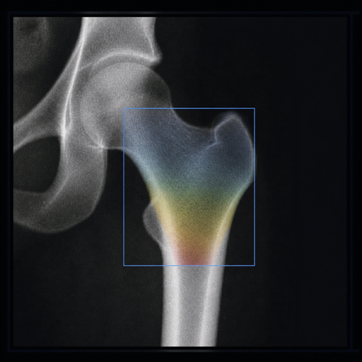 Representative DEXA bone-density image.