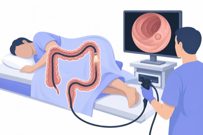 Illustration of a flexible endoscope inside the colon with the video view on a monitor.
