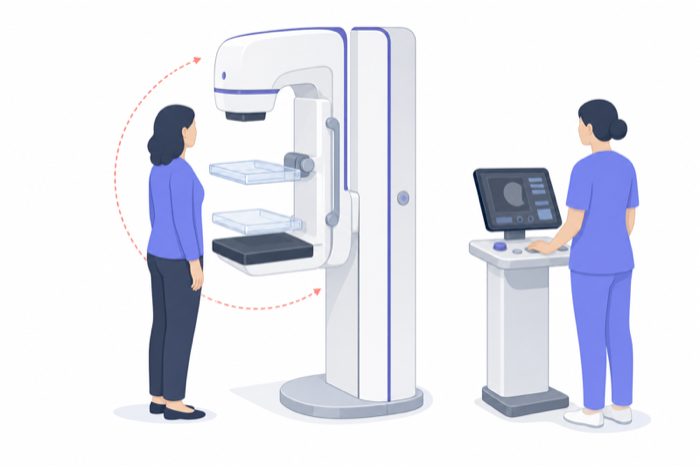 Illustration of a patient at a mammography unit with compression paddles and a sweeping X-ray tube.