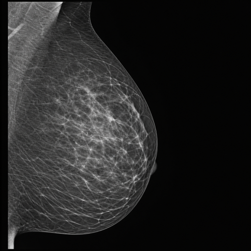 Representative mammography image.