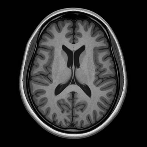 Representative axial T1-weighted brain MRI image.