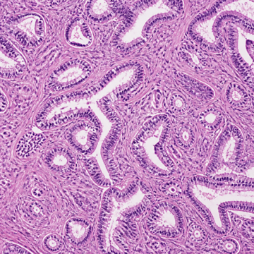 Representative hematoxylin-and-eosin histology image.