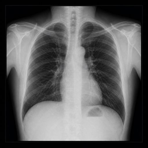 Representative chest X-ray image.