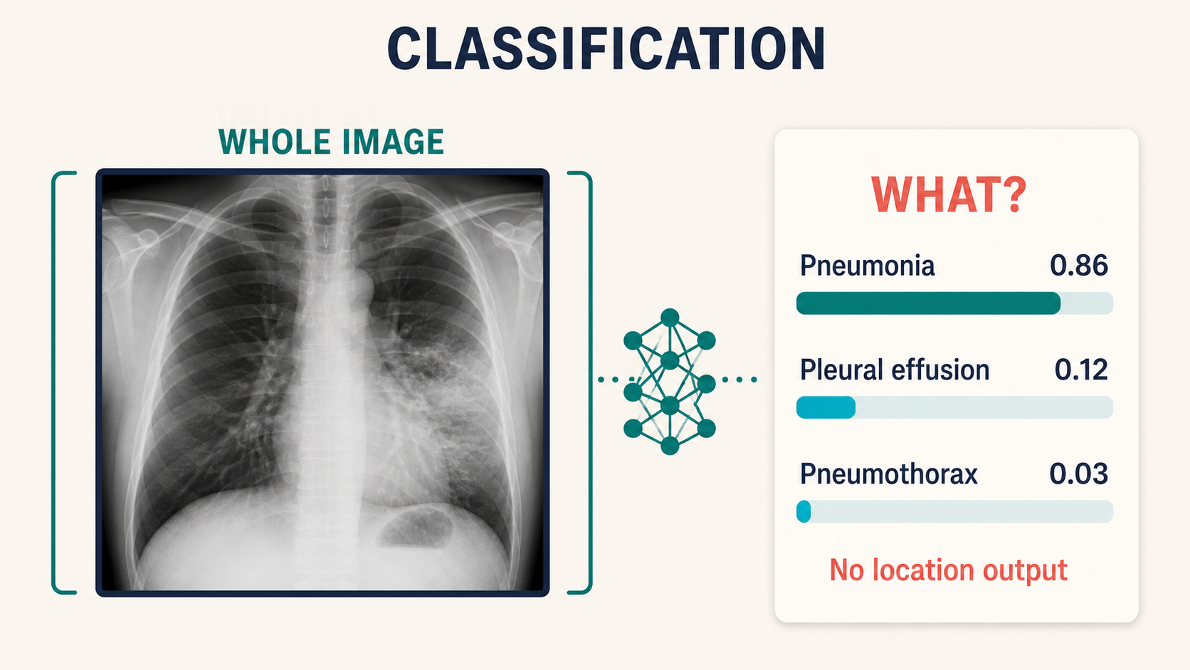 A chest radiograph is treated as one whole input and mapped to probabilities for pneumonia, pleural effusion, and pneumothorax. No box, contour, or location is shown.
