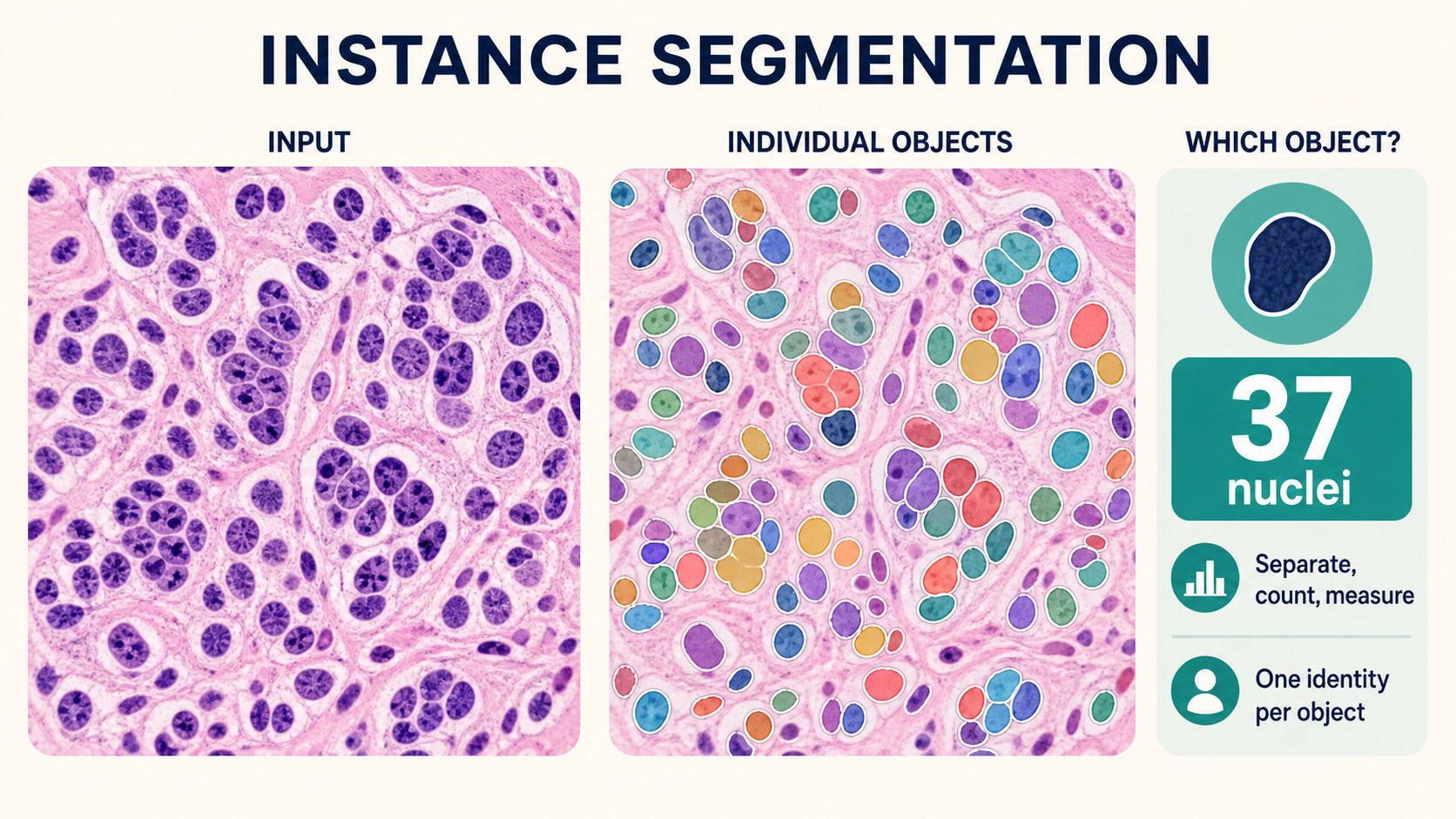 An H-and-E histology field is shown beside an overlay where individual nuclei have separate colored masks and boundaries. A result card reports a nucleus count and per-object measurement capability.
